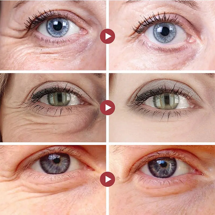 Eelhoe Anti-Wrinkle Eye Cream - wellvy wellness store