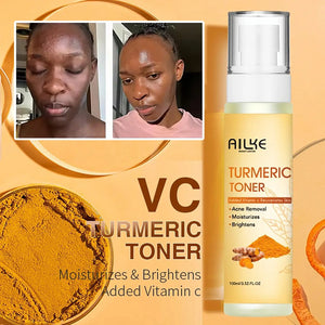 AILKE Organic Turmeric Vitamin C Facial Essence Toner – Anti-Acne, Brightening & Hydrating (100ml) wellvy wellness store