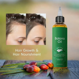 Dersie Batana Oil bottle with 'Before' and 'After' hair growth comparison on a natural background.