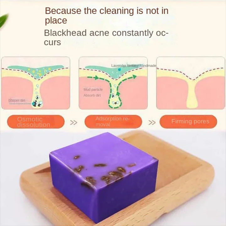 Maruomiki Lavender Anti-Acne Handmade Soap: Skin Cleansing & Oil Control - wellvy wellness store