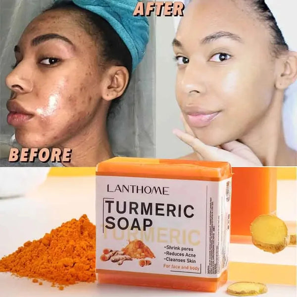 Cappuvini Turmeric & Ginger Handmade Soap: Anti-Acne & Skin Brightening - wellvy wellness store
