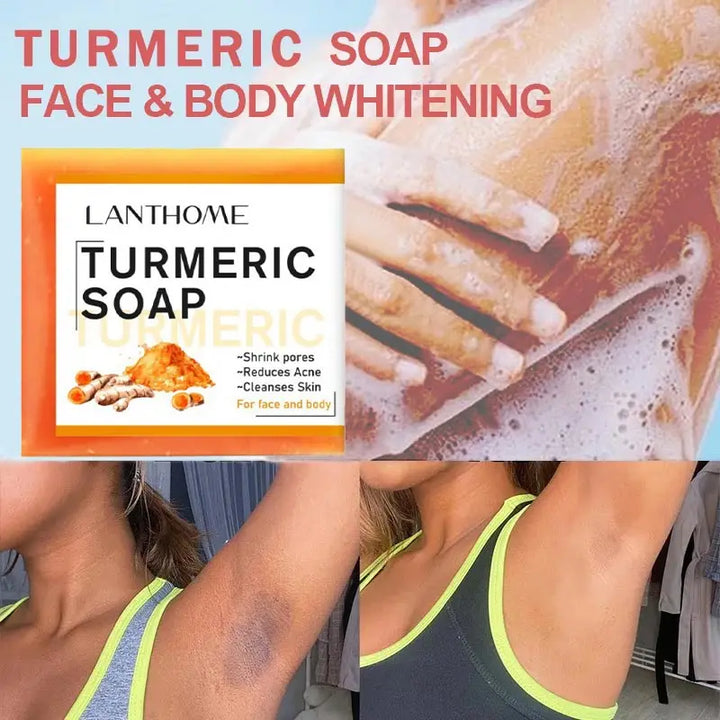 Cappuvini Turmeric & Ginger Handmade Soap: Anti-Acne & Skin Brightening - wellvy wellness store